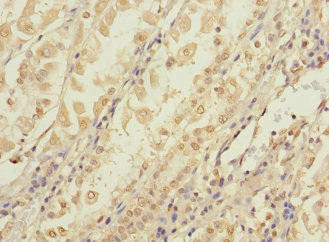 CCDC150 Antibody (PACO38566)