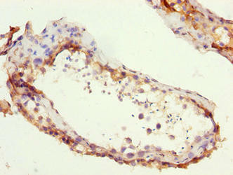 ZCCHC13 Antibody (PACO38642)