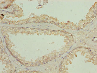 N4BP2L2 Antibody (PACO38662)
