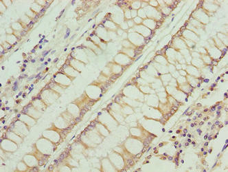 RFESD Antibody (PACO38826)