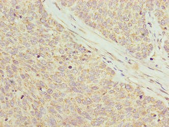 PPDPFL Antibody (PACO38874)
