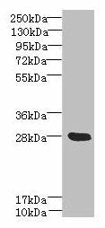 YIPF5 Antibody (PACO38906)