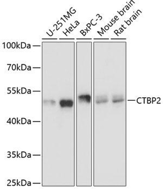 Anti-CTBP2 Antibody (CAB2257)
