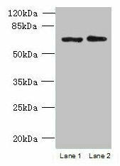 TBC1D19 Antibody (PACO39086)