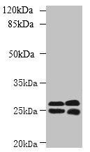 CMBL Antibody (PACO39282)