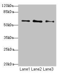 GPR101 Antibody (PACO39338)