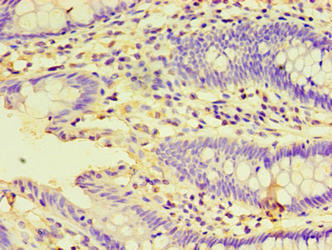 HSPBAP1 Antibody (PACO39822)