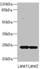 MRAP2 Antibody (PACO39834)