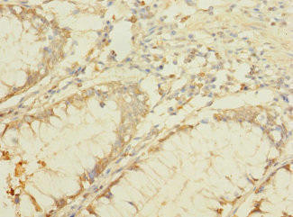 B4GALNT2 Antibody (PACO39962)