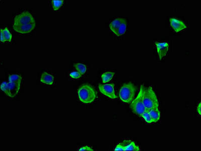 SEC22A Antibody (PACO40142)