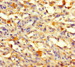 VPS50 Antibody (PACO40154)