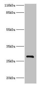 HSD17B14 Antibody (PACO40230)