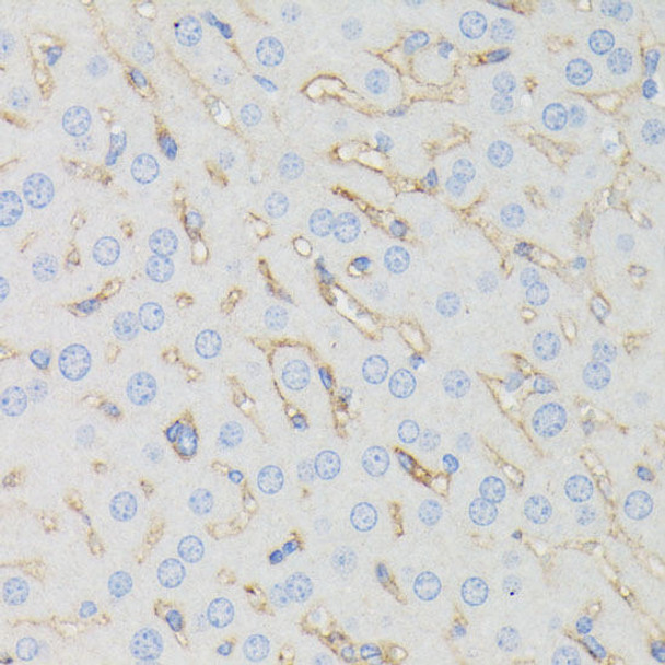 Anti-IFITM1 Antibody (CAB4228)