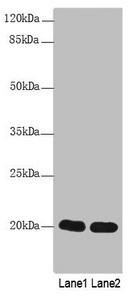 CABP5 Antibody (PACO40626)