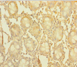 CCDC94 Antibody (PACO40730)