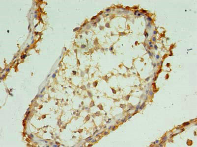 XAGE1A Antibody (PACO41142)