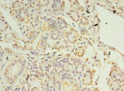 MCUB Antibody (PACO41186)