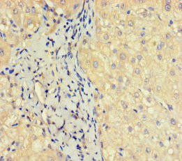 OBP2A Antibody (PACO41202)