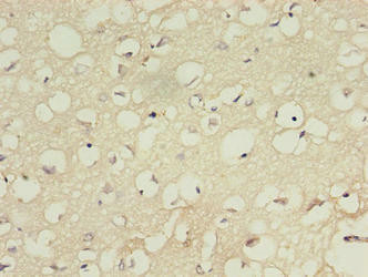 IFT27 Antibody (PACO41262)
