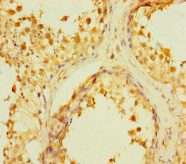 RAB6C Antibody (PACO41314)