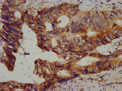 CHMP5 Antibody (PACO41490)