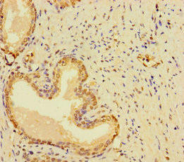 RABEP2 Antibody (PACO41634)