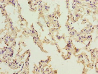 NINJ2 Antibody (PACO42002)
