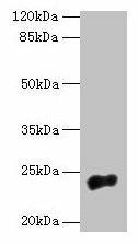 NACA2 Antibody (PACO42146)