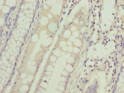 HIGD1B Antibody (PACO42302)