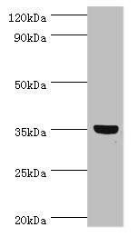 GLYATL1 Antibody (PACO43964)