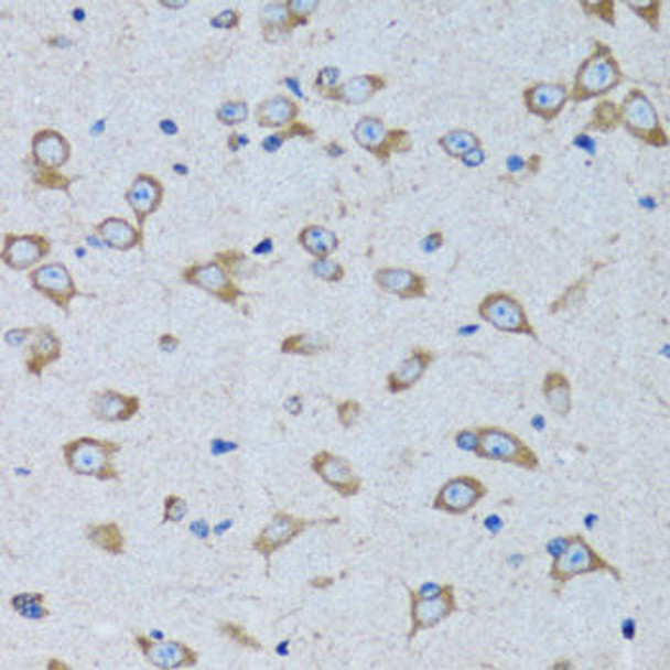Anti-RARS Antibody (CAB6307)