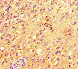 ACOD1 Antibody (PACO45950)