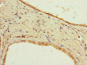 PPP2R2D Antibody (PACO46614)