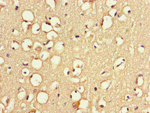 ZNF365 Antibody (PACO46694)