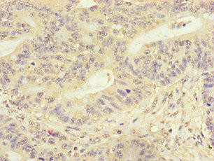 FMNL3 Antibody (PACO46786)