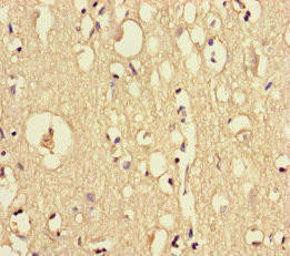DOCK6 Antibody (PACO46942)