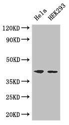 ACTG1 Antibody (PACO47746)