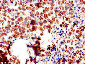 AQP6 Antibody (PACO48558)