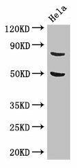 KBTBD6 Antibody (PACO48670)