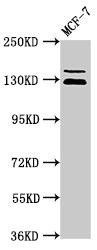 ZNF335 Antibody (PACO49082)