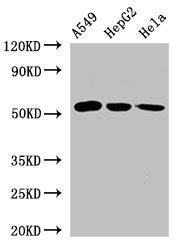 ONECUT2 Antibody (PACO49834)