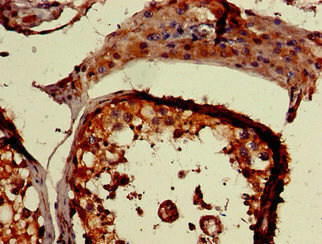 PLCD1 Antibody (PACO49878)