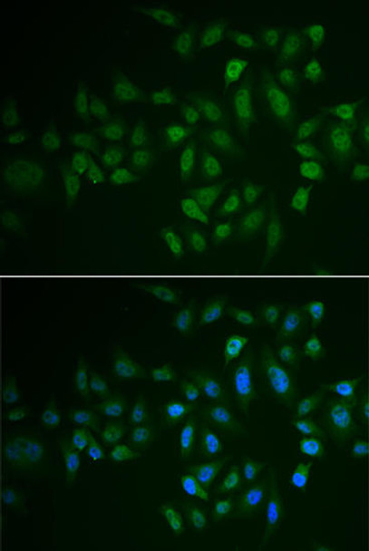 Anti-MYLK3 Antibody (CAB6663)