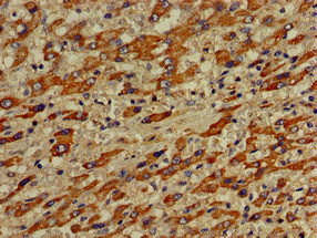 VPS33A Antibody (PACO50890)