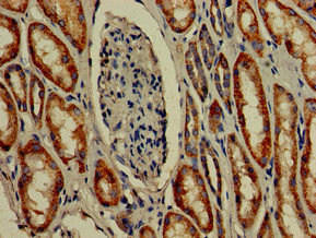 TMIGD2 Antibody (PACO50894)