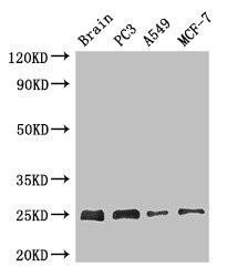 APOPT1 Antibody (PACO50902)