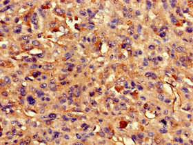 ARAP3 Antibody (PACO52542)