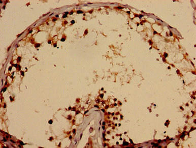 TBC1D31 Antibody (PACO52554)