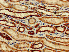 SNCAIP Antibody (PACO52918)