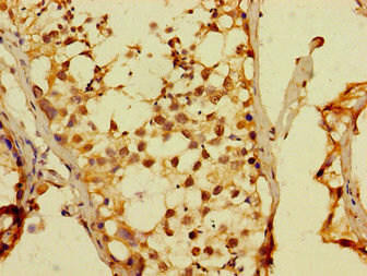 DUX4 Antibody (PACO52982)